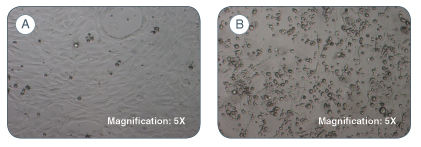 Primary human bone marrow-derived MSCs show less hematopoietic cell contamination when cultured in (A) MesenCult™-XF compared to a (B) traditional serum-based medium